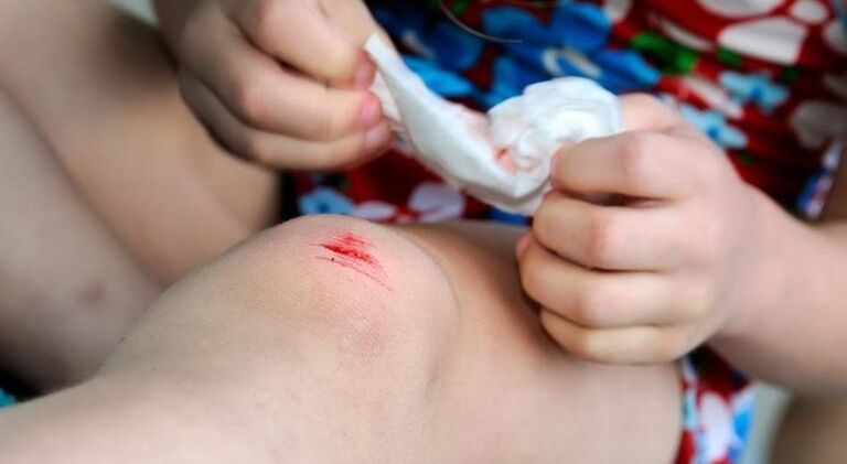 Come puoi ottenere un'infezione con un fungo